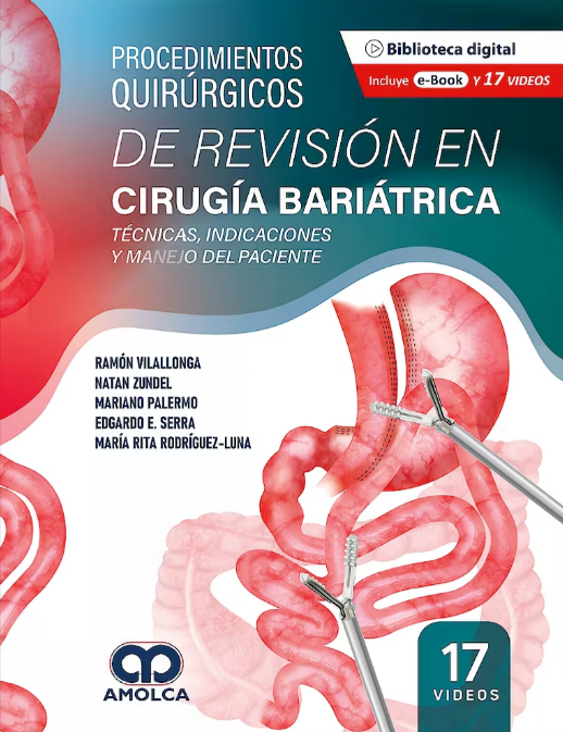 Procedimientos Quirúrgicos de Revisión en Cirugía Bariátrica. Técnicas, Indicaciones y Manejo del Paciente